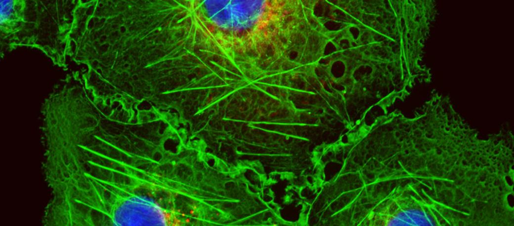 Excelitas entwirft和fertigt Beleuchtungs、Optik和Detektionskomponenten和Subsysteme毛皮大幅减退biologische和Biotechnologie死去