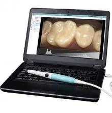 excelitas.USB Dental Camera System